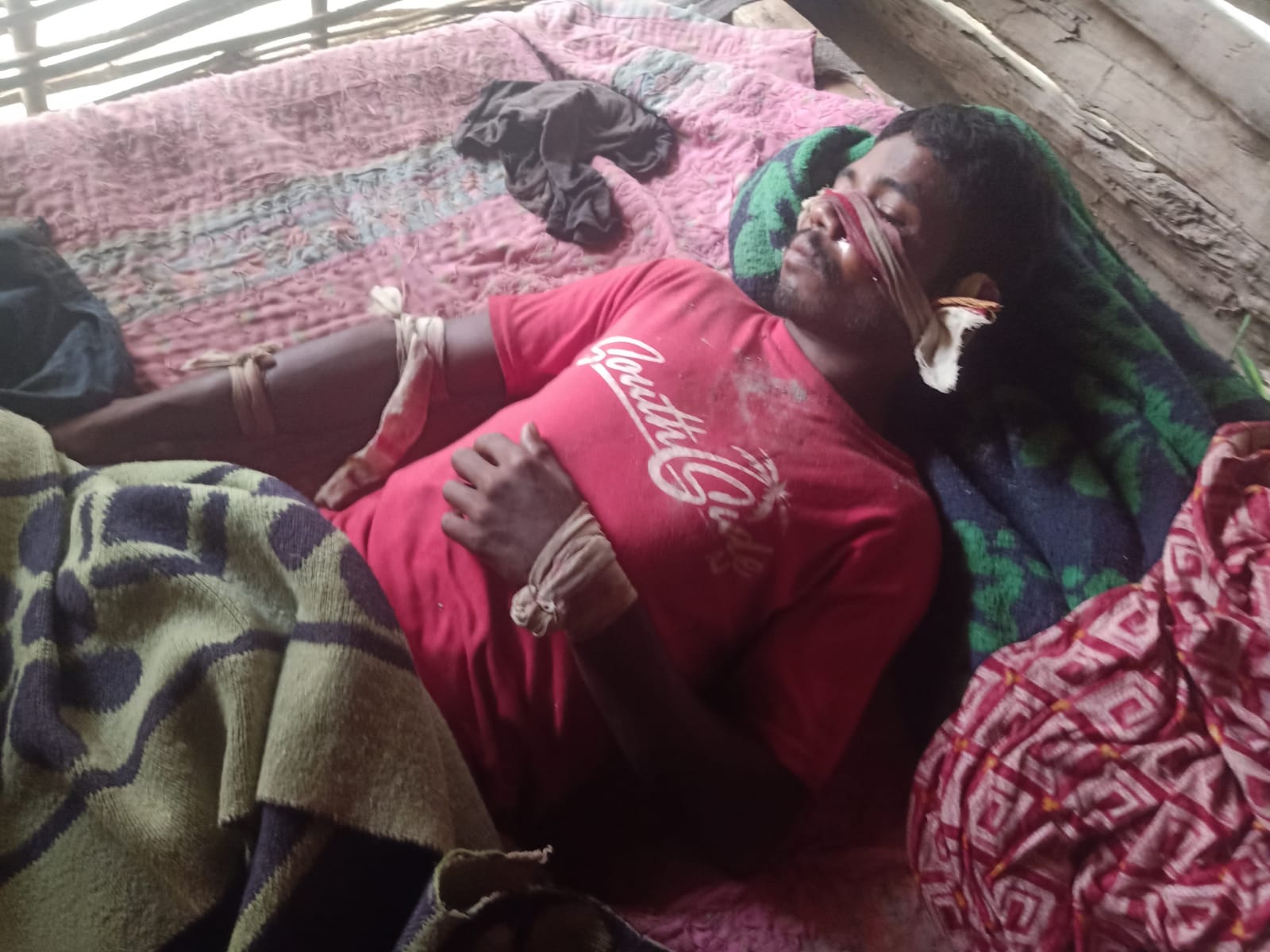 * बाघ के हमले में ग्रामीण घायल, वन विभाग ने तत्काल अस्पताल पहुंचाकर कराया उपचार *